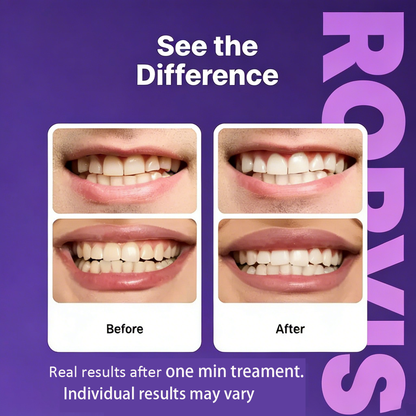 RORVIS™Whiter-Looking Teeth From The First Use — Without The Harsh Strip Experience